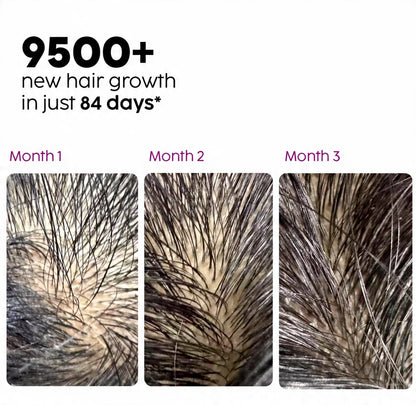 Extreme Hair Growth Oil 100 ML